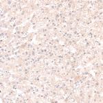SOX4 Antibody in Immunohistochemistry (Paraffin) (IHC (P))