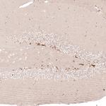 SOX4 Antibody in Immunohistochemistry (Paraffin) (IHC (P))