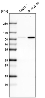 SOX6 Monoclonal Antibody (CL5685)