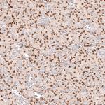 SOX6 Antibody in Immunohistochemistry (Paraffin) (IHC (P))
