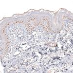 SOX6 Antibody in Immunohistochemistry (Paraffin) (IHC (P))