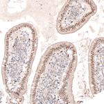 SOX6 Antibody in Immunohistochemistry (Paraffin) (IHC (P))