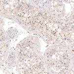 SOX6 Antibody in Immunohistochemistry (Paraffin) (IHC (P))