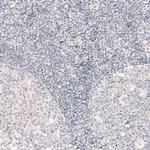 SOX6 Antibody in Immunohistochemistry (Paraffin) (IHC (P))