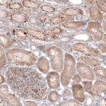 G6PC Monoclonal Antibody (CL5817)