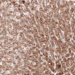 G6PC Antibody in Immunohistochemistry (Paraffin) (IHC (P))