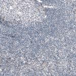 G6PC Antibody in Immunohistochemistry (Paraffin) (IHC (P))