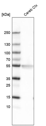 LHX2 Antibody in Western Blot (WB)