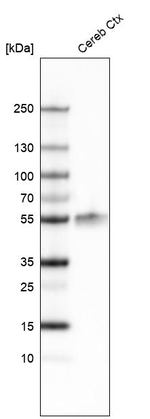LHX2 Antibody in Western Blot (WB)