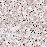 TBX19 Monoclonal Antibody (CL6251)