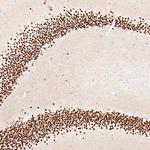 BCL11B Monoclonal Antibody (CL6426)