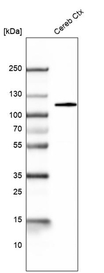 BCL11B Antibody in Western Blot (WB)
