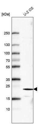 FGF21 Monoclonal Antibody (CL6491)