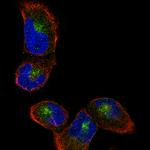 Sortilin Monoclonal Antibody (CL6526)