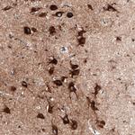 Sortilin Antibody in Immunohistochemistry (Paraffin) (IHC (P))