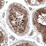 Sortilin Antibody in Immunohistochemistry (Paraffin) (IHC (P))