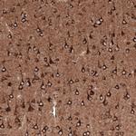 Sortilin Antibody in Immunohistochemistry (Paraffin) (IHC (P))