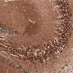 Sortilin Antibody in Immunohistochemistry (Paraffin) (IHC (P))