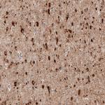 Sortilin Antibody in Immunohistochemistry (Paraffin) (IHC (P))
