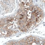 Sortilin Antibody in Immunohistochemistry (Paraffin) (IHC (P))