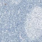 Sortilin Antibody in Immunohistochemistry (Paraffin) (IHC (P))