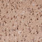 Sortilin Antibody in Immunohistochemistry (Paraffin) (IHC (P))