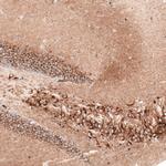 Sortilin Monoclonal Antibody (CL6528)