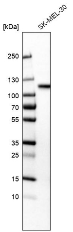 Sortilin Antibody in Western Blot (WB)