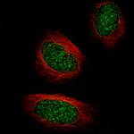 TET2 Monoclonal Antibody (CL6873)