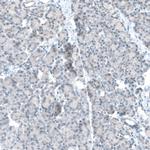 TET2 Antibody in Immunohistochemistry (Paraffin) (IHC (P))