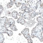 TET2 Antibody in Immunohistochemistry (Paraffin) (IHC (P))