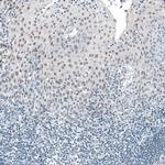 TET2 Antibody in Immunohistochemistry (Paraffin) (IHC (P))