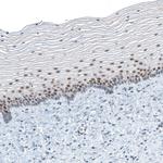 TET2 Antibody in Immunohistochemistry (Paraffin) (IHC (P))