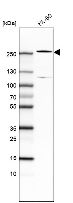 TET2 Antibody in Western Blot (WB)
