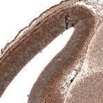 AUTS2 Monoclonal Antibody (CL7067)