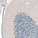 AUTS2 Antibody in Immunohistochemistry (Paraffin) (IHC (P))