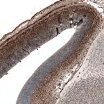 AUTS2 Antibody in Immunohistochemistry (Paraffin) (IHC (P))