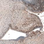 AUTS2 Monoclonal Antibody (CL7084)