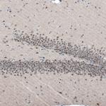 AUTS2 Antibody in Immunohistochemistry (Paraffin) (IHC (P))