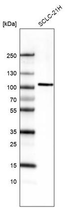 AUTS2 Antibody in Western Blot (WB)