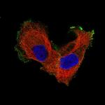 ITGB8 Antibody in Immunocytochemistry (ICC/IF)