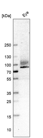 ITGB8 Antibody in Western Blot (WB)