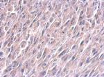 LIN28A Antibody in Immunohistochemistry (Paraffin) (IHC (P))