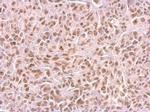 SAMHD1 Monoclonal Antibody (GT851)