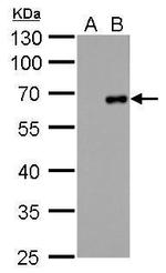 Factor X/Xa Antibody in Western Blot (WB)