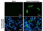 Factor X/Xa Monoclonal Antibody (GT268)