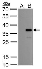 COL11A2 Monoclonal Antibody (GT6410)