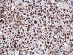 CFDP1 Antibody in Immunohistochemistry (Paraffin) (IHC (P))