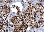 CFDP1 Antibody in Immunohistochemistry (Paraffin) (IHC (P))