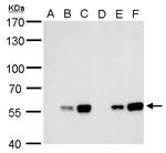 Carbonic Anhydrase IX Antibody in Western Blot (WB)